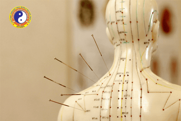 Master Diploma in Acupuncture Therapy