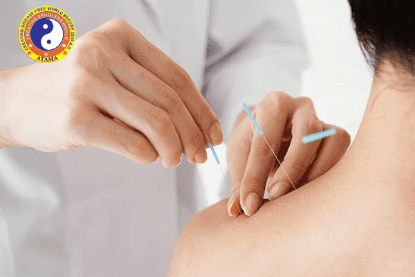 acupuncture certificate course in karaikudi