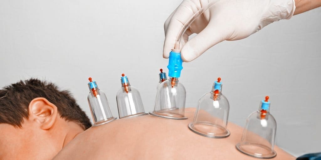 Hijama