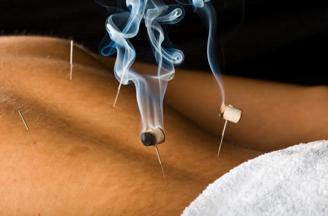 Moxibustion